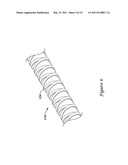 STENT DELIVERY SYSTEM diagram and image