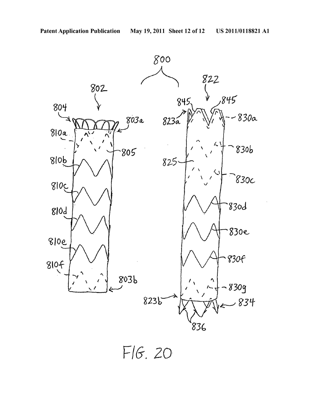 LOW PROFILE NON-SYMMETRICAL STENT - diagram, schematic, and image 13