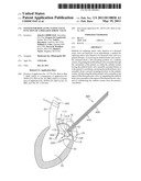 System For Replacing Native Valve Function Of A Diseased Aortic Valve diagram and image