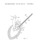 System For Replacing Native Valve Function Of A Diseased Aortic Valve diagram and image