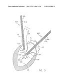 System For Replacing Native Valve Function Of A Diseased Aortic Valve diagram and image