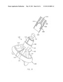 System For Replacing Native Valve Function Of A Diseased Aortic Valve diagram and image