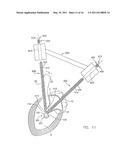 System For Replacing Native Valve Function Of A Diseased Aortic Valve diagram and image