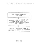 System For Replacing Native Valve Function Of A Diseased Aortic Valve diagram and image