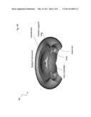 FLUIDIC INTRAOCULAR LENS SYSTEMS AND METHODS diagram and image