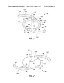 MARK FOR INTRAOCULAR LENSES diagram and image