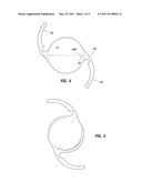 MARK FOR INTRAOCULAR LENSES diagram and image