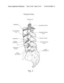 APPARATUS, SYSTEMS, AND METHODS FOR ACHIEVING TRANS-ILIAC LUMBAR FUSION diagram and image