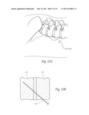 APPARATUS, SYSTEMS, AND METHODS FOR ACHIEVING TRANS-ILIAC LUMBAR FUSION diagram and image