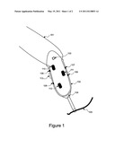 Prosthetic Socket Stabilization Apparatus and Technique diagram and image