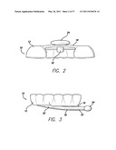 SLEEP APPLIANCE diagram and image