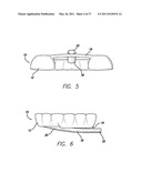 SLEEP APPLIANCE diagram and image