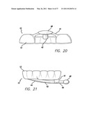 SLEEP APPLIANCE diagram and image