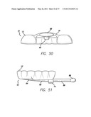 SLEEP APPLIANCE diagram and image