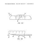 SLEEP APPLIANCE diagram and image