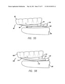 SLEEP APPLIANCE diagram and image