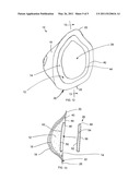 Method of Forming a Breast Prosthesis diagram and image