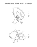 LEAD SCREW LOCKING DEVICE diagram and image