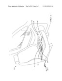 SEAT OCCUPANT DETECTION CIRCUIT ISOLATION FROM SEAT HEATING CIRCUIT USING A COMMON MODE CHOKE diagram and image