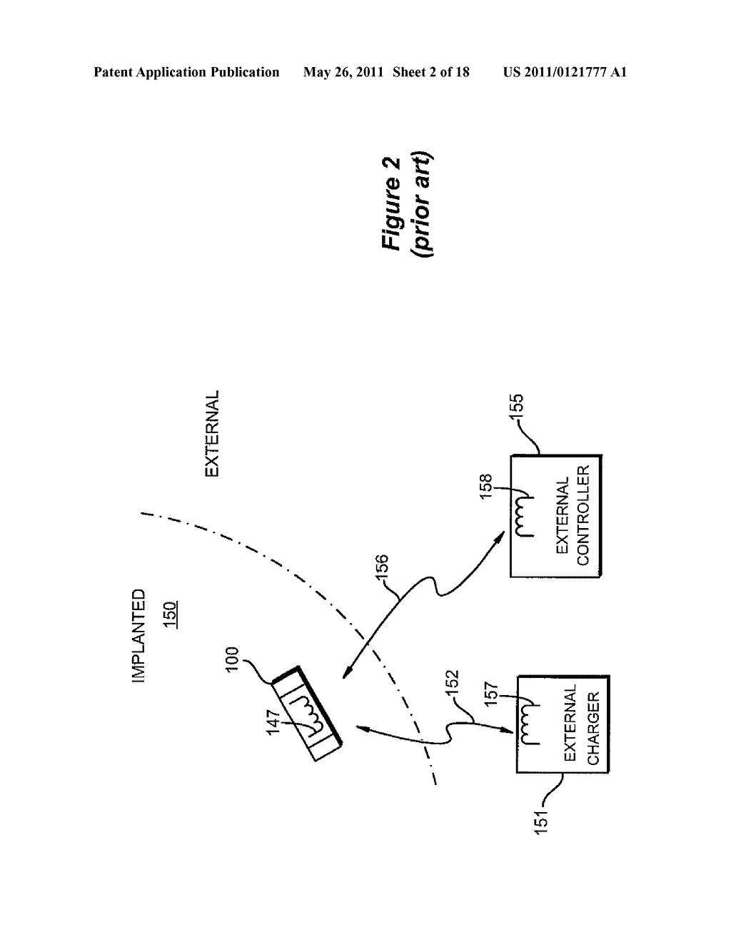 Efficient External Charger for Charging a Plurality of Implantable Medical Devices - diagram, schematic, and image 03