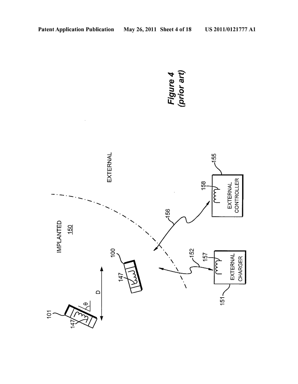 Efficient External Charger for Charging a Plurality of Implantable Medical Devices - diagram, schematic, and image 05