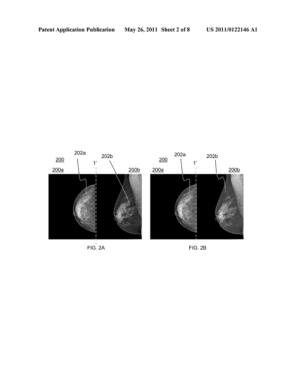 SYSTEMS AND METHODS FOR MATCHING MEDICAL IMAGES - diagram, schematic, and image 03