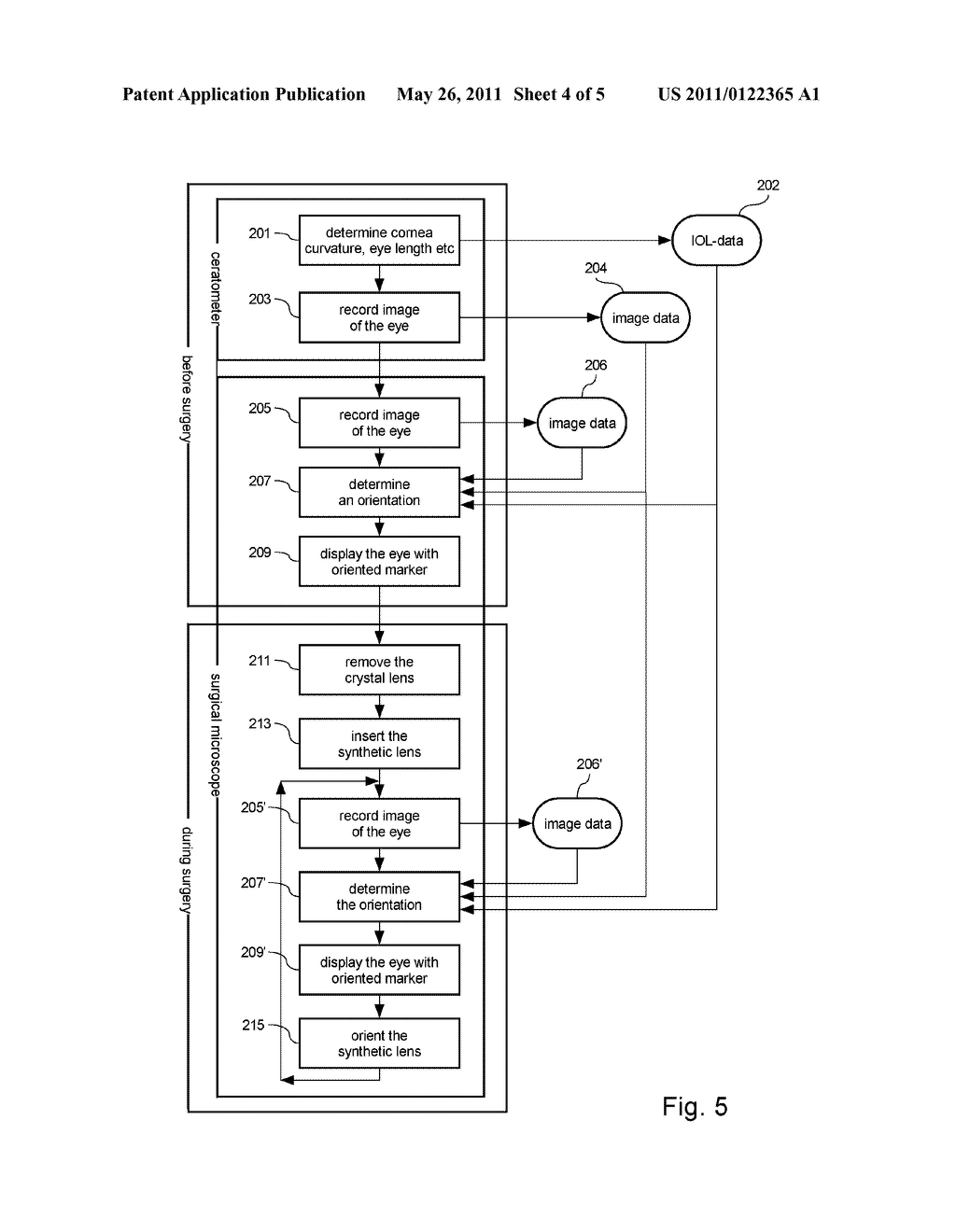 Eye Surgery System and Methods of Preparing and Performing an Eye Surgery - diagram, schematic, and image 05