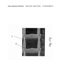 X-RAY IMAGING SYSTEM AND METHOD diagram and image