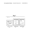 MAMMOGRAPHY STATISTICAL DIAGNOSTIC PROFILER AND PREDICTION SYSTEM diagram and image