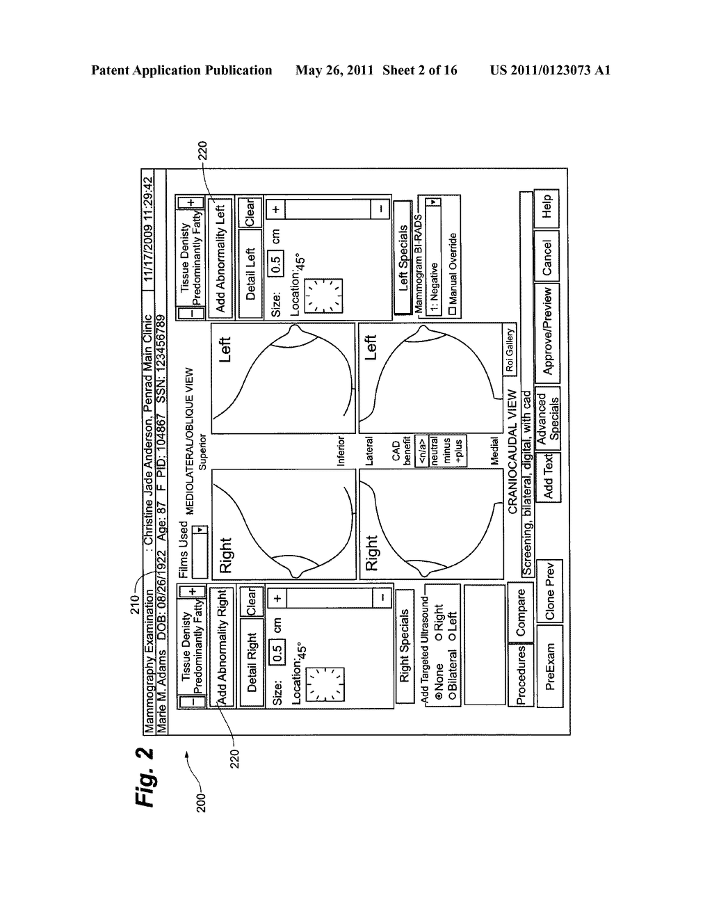 MAMMOGRAPHY STATISTICAL DIAGNOSTIC PROFILER AND PREDICTION SYSTEM - diagram, schematic, and image 03