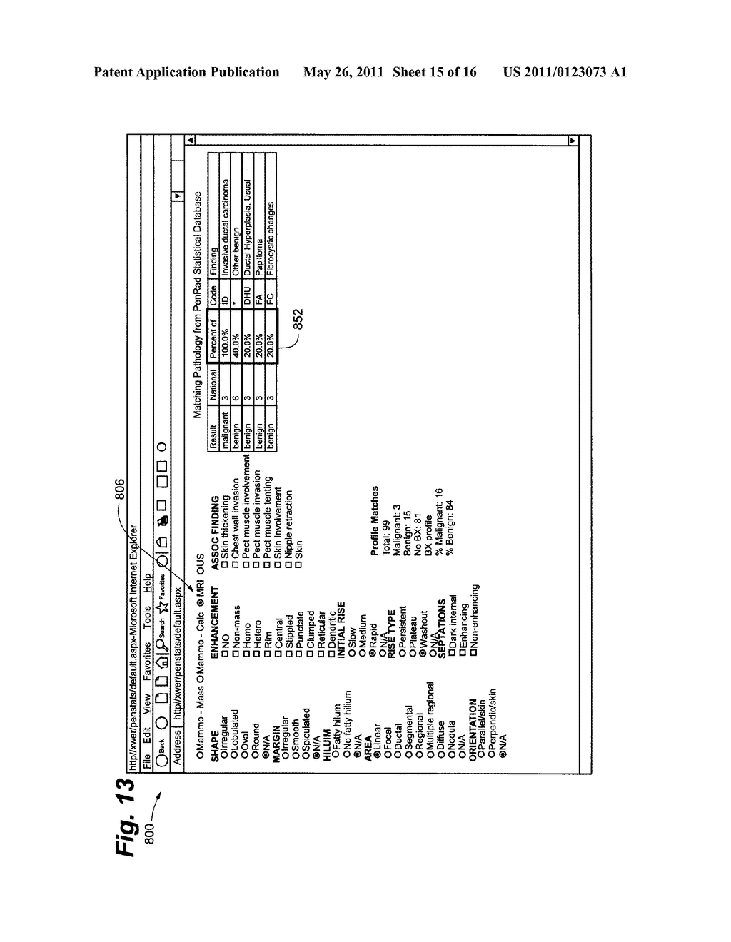 MAMMOGRAPHY STATISTICAL DIAGNOSTIC PROFILER AND PREDICTION SYSTEM - diagram, schematic, and image 16