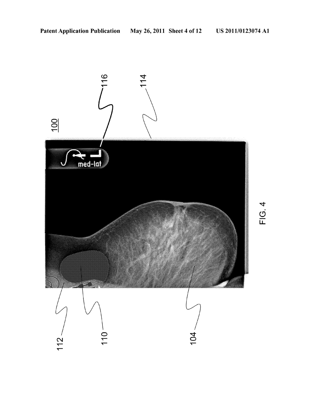 SYSTEMS AND METHODS FOR SUPPRESSING ARTIFICIAL OBJECTS IN MEDICAL IMAGES - diagram, schematic, and image 05