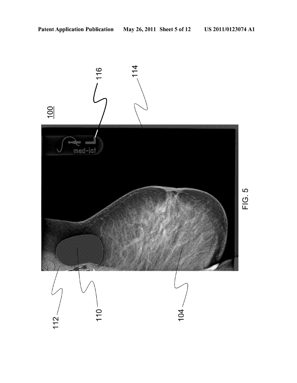 SYSTEMS AND METHODS FOR SUPPRESSING ARTIFICIAL OBJECTS IN MEDICAL IMAGES - diagram, schematic, and image 06