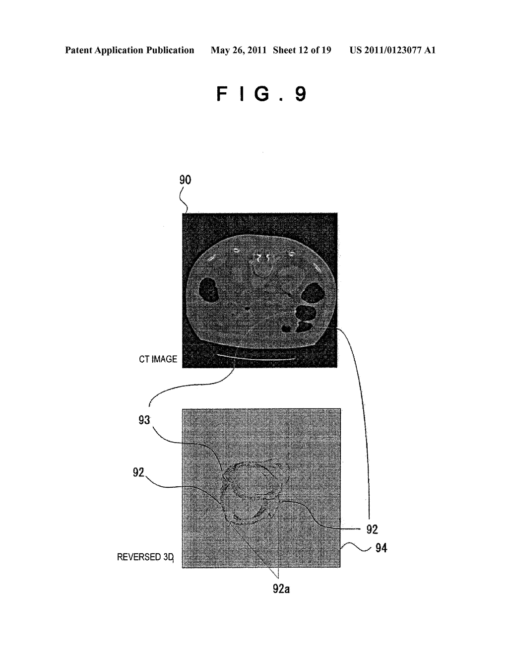 IMAGE DISPLAY DEVICE, METHOD AND PROGRAM - diagram, schematic, and image 13