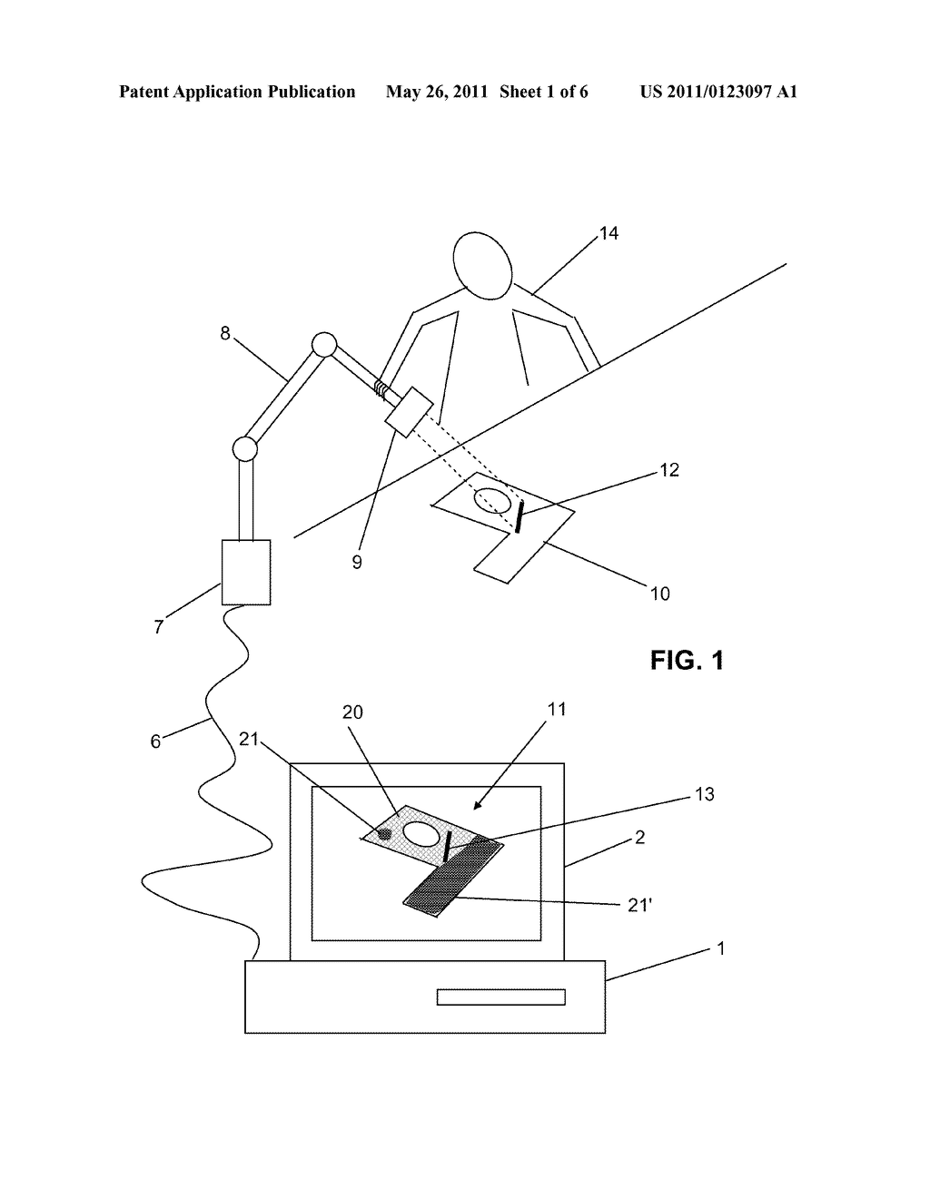 Method and computer program for improving the dimensional acquisition of an object - diagram, schematic, and image 02