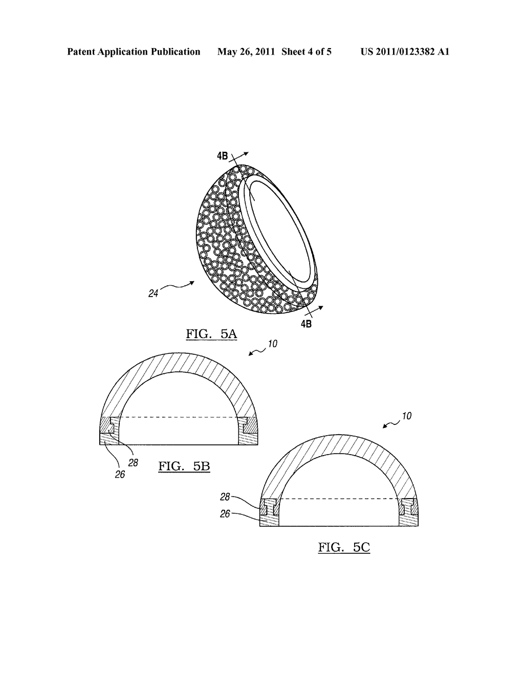 METHOD AND APPARATUS FOR FORMING POROUS METAL IMPLANTS - diagram, schematic, and image 05