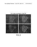 PANCREATIC BETA-CELL MASS BIOMARKER diagram and image