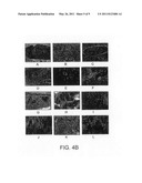 METHODS AND COMPOSITIONS FOR TREATING FUS1 RELATED DISORDERS diagram and image