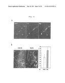 COMPOSITION COMPRISING EXPRESSION OR ACTIVITY INHIBITORS OF NINJURIN 1 FOR THE PREVENTION AND TREATMENT OF INFLAMMATORY DISEASE diagram and image