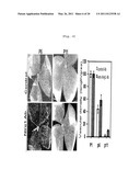 COMPOSITION COMPRISING EXPRESSION OR ACTIVITY INHIBITORS OF NINJURIN 1 FOR THE PREVENTION AND TREATMENT OF INFLAMMATORY DISEASE diagram and image