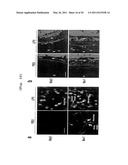 COMPOSITION COMPRISING EXPRESSION OR ACTIVITY INHIBITORS OF NINJURIN 1 FOR THE PREVENTION AND TREATMENT OF INFLAMMATORY DISEASE diagram and image