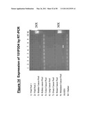 NUCLEIC ACID AND CORRESPONDING PROTEIN ENTITLED 151P3D4 USEFUL IN TREATMENT AND DETECTION OF CANCER diagram and image