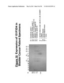 NUCLEIC ACID AND CORRESPONDING PROTEIN ENTITLED 151P3D4 USEFUL IN TREATMENT AND DETECTION OF CANCER diagram and image