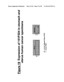 NUCLEIC ACID AND CORRESPONDING PROTEIN ENTITLED 151P3D4 USEFUL IN TREATMENT AND DETECTION OF CANCER diagram and image