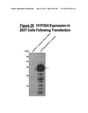 NUCLEIC ACID AND CORRESPONDING PROTEIN ENTITLED 151P3D4 USEFUL IN TREATMENT AND DETECTION OF CANCER diagram and image