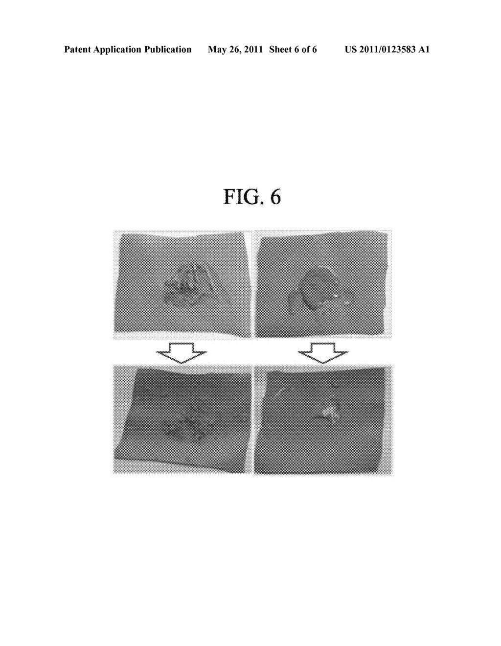 MULTI-LAYERED LAMELLAR GRANULE AND SKIN EXTERNAL APPLICATION COMPOSITION CONTAINING SAME - diagram, schematic, and image 07