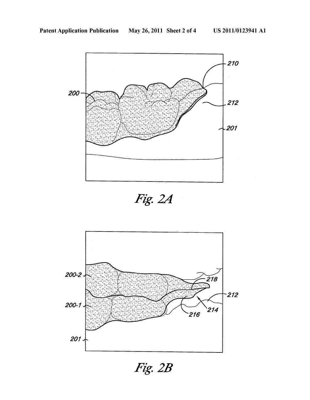 TABBED DENTAL APPLIANCE - diagram, schematic, and image 03