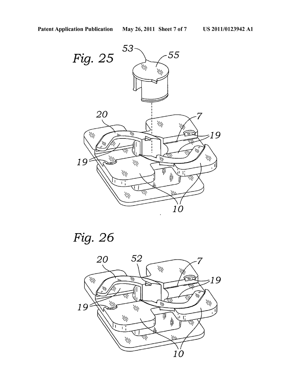 Rotating clip orthodontic bracket - diagram, schematic, and image 08