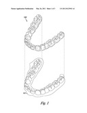 TRACKING TEETH MOVEMENT CORRECTION diagram and image