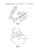 TRACKING TEETH MOVEMENT CORRECTION diagram and image